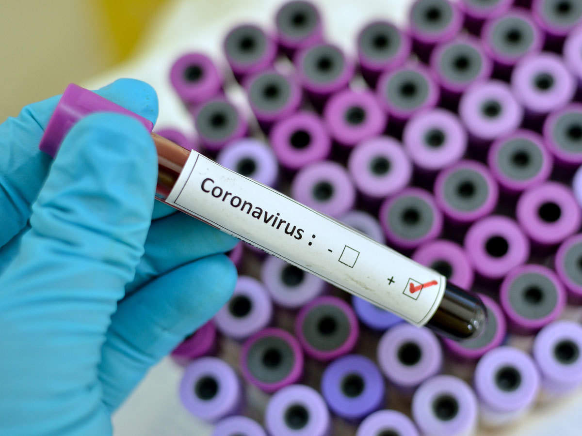 Коронавирустан сақтану шаралары Коронавирустан сақтану шаралары - на health.bugin.kz